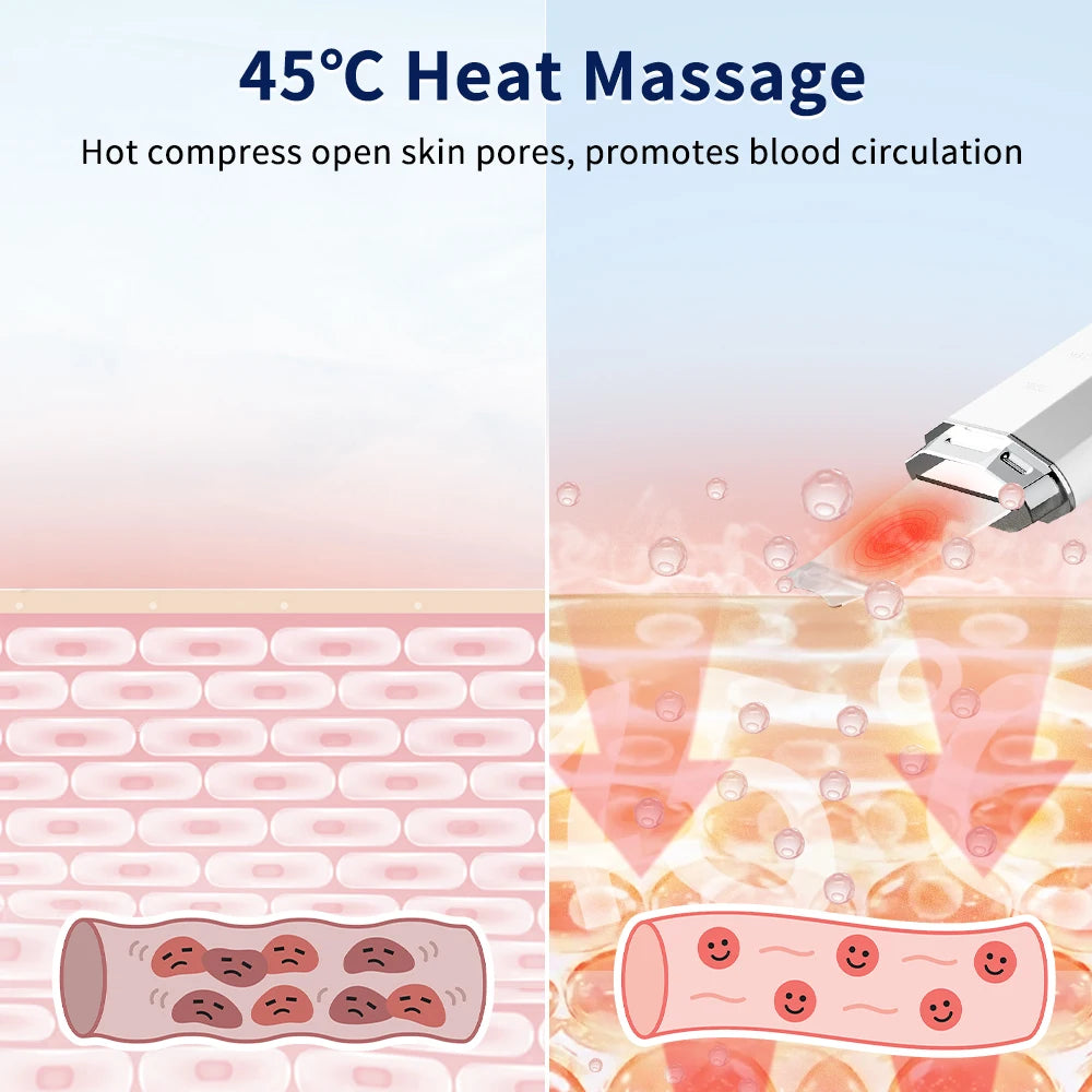 ANLAN Ultrasonic Skin Scrubber – Ion Deep Cleansing & EMS Lifting Device