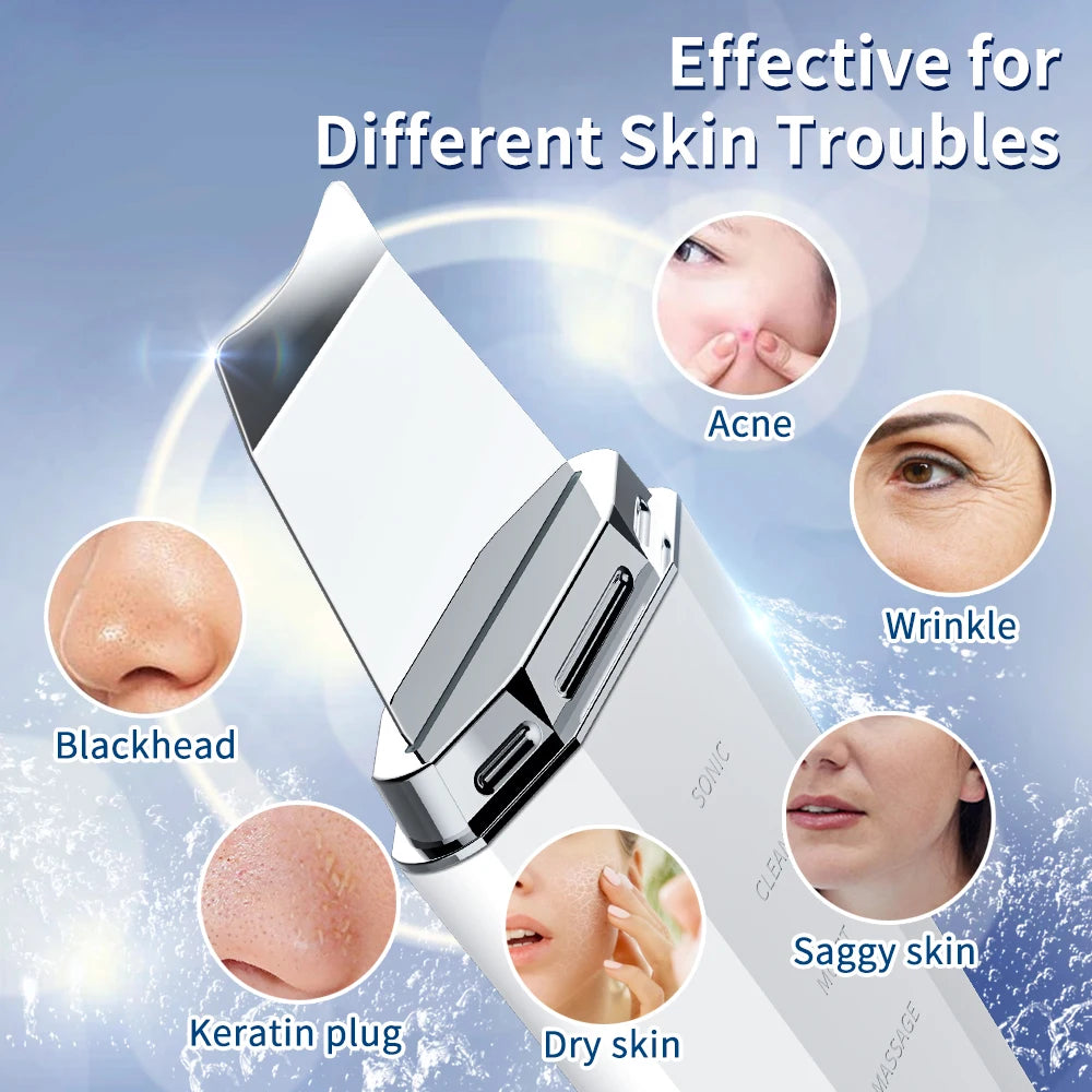 ANLAN Ultrasonic Skin Scrubber – Ion Deep Cleansing & EMS Lifting Device