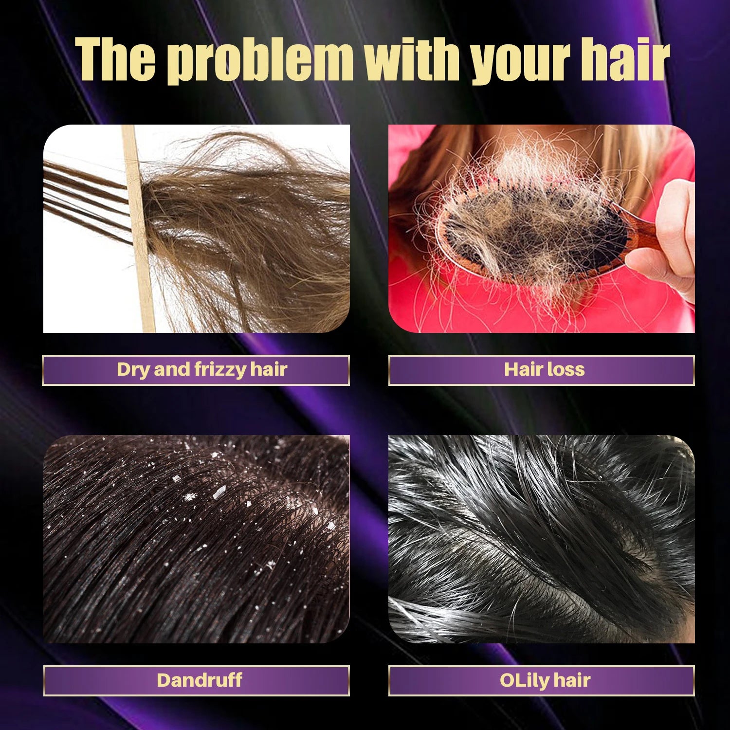 Rosemary Onion Hair Growth Set – Anti-Hair Loss Shampoo & Spray