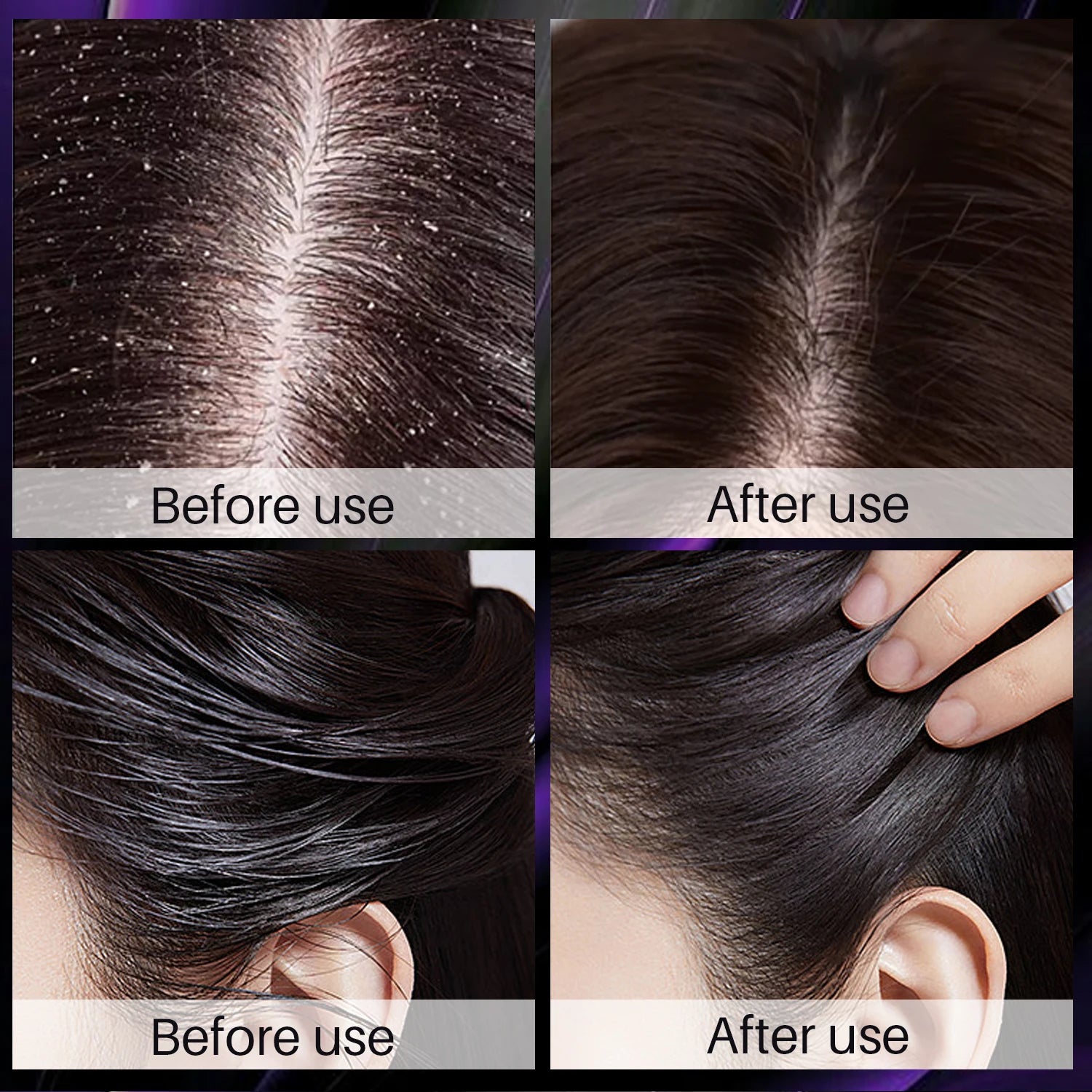 Rosemary Onion Hair Growth Set – Anti-Hair Loss Shampoo & Spray