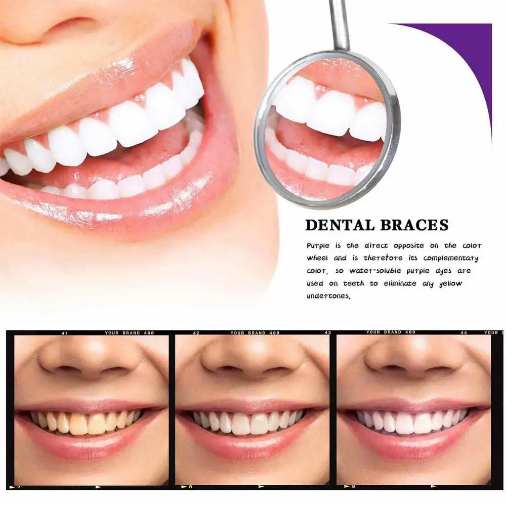 Purple Toothpaste – Instant Whitening & Stain Removal