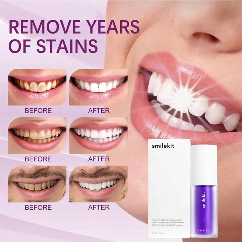Purple Toothpaste – Instant Whitening & Stain Removal